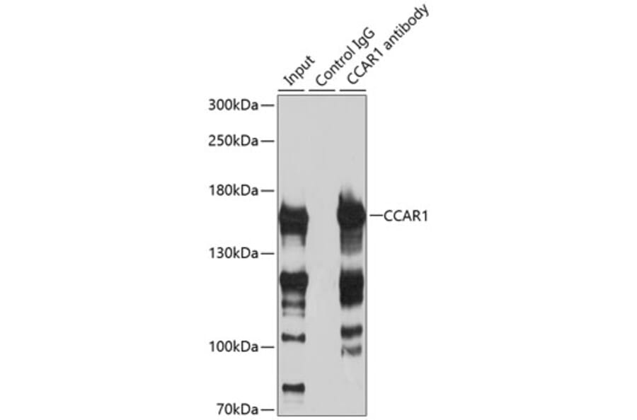 Western Blot - Anti-DIS Antibody (A88366) - Antibodies.com