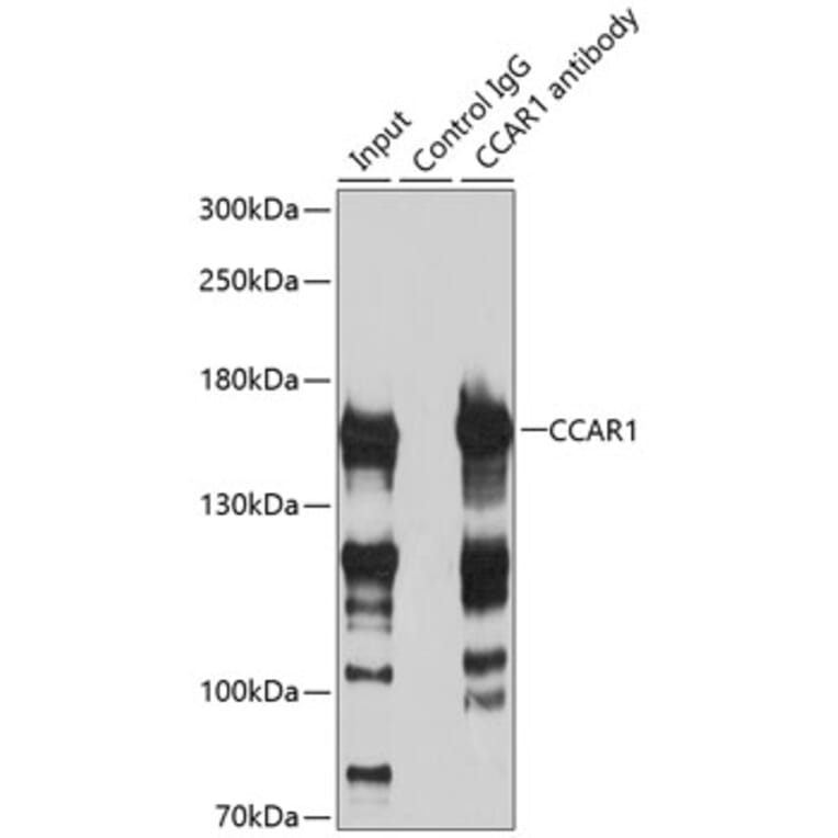 Western Blot - Anti-DIS Antibody (A88366) - Antibodies.com