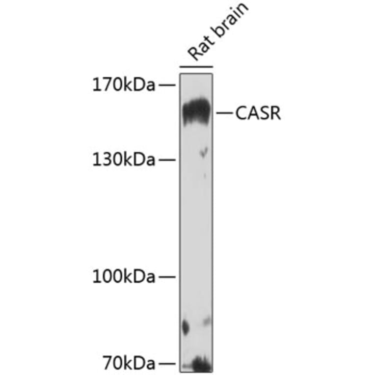 Western Blot - Anti-CASR Antibody (A13000) - Antibodies.com