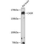 Western Blot - Anti-CASR Antibody (A13000) - Antibodies.com