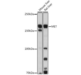 Western Blot - Anti-Met (c-Met) Antibody (A88368) - Antibodies.com