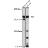 Western Blot - Anti-Met (c-Met) Antibody (A88368) - Antibodies.com