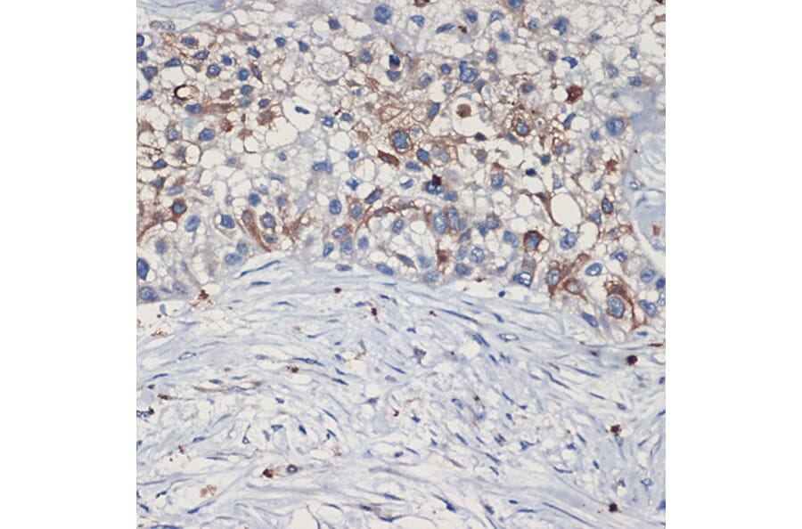 Immunohistochemistry - Anti-Met (c-Met) Antibody (A88368) - Antibodies.com