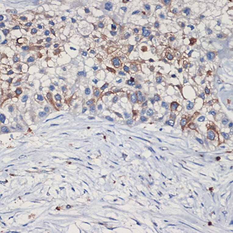 Immunohistochemistry - Anti-Met (c-Met) Antibody (A88368) - Antibodies.com
