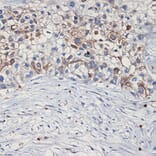 Immunohistochemistry - Anti-Met (c-Met) Antibody (A88368) - Antibodies.com
