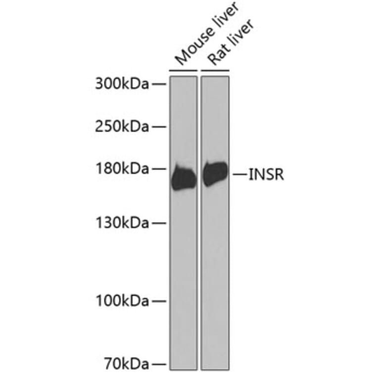 Western Blot - Anti-INSR Antibody (A0005) - Antibodies.com