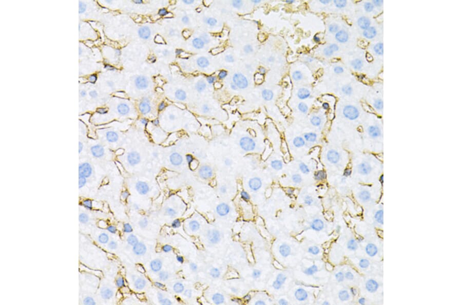 Immunohistochemistry - Anti-INSR Antibody (A0005) - Antibodies.com
