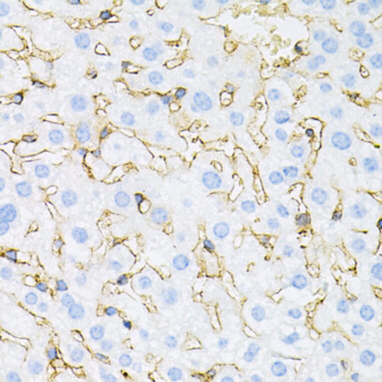 Immunohistochemistry - Anti-INSR Antibody (A0005) - Antibodies.com