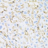Immunohistochemistry - Anti-INSR Antibody (A0005) - Antibodies.com