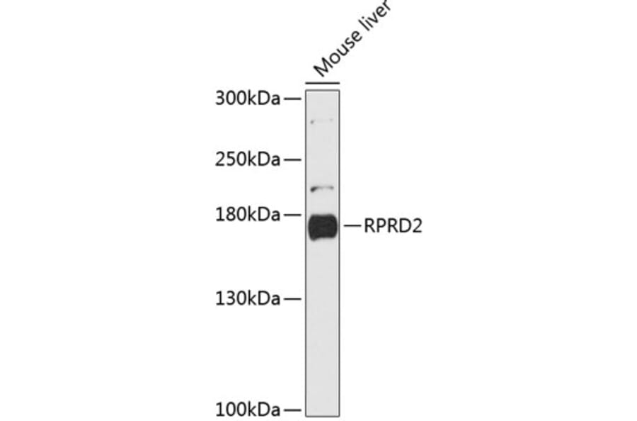 Western Blot - Anti-RPRD2 Antibody (A88370) - Antibodies.com
