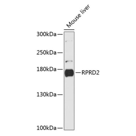 Western Blot - Anti-RPRD2 Antibody (A88370) - Antibodies.com