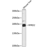 Western Blot - Anti-RPRD2 Antibody (A88370) - Antibodies.com