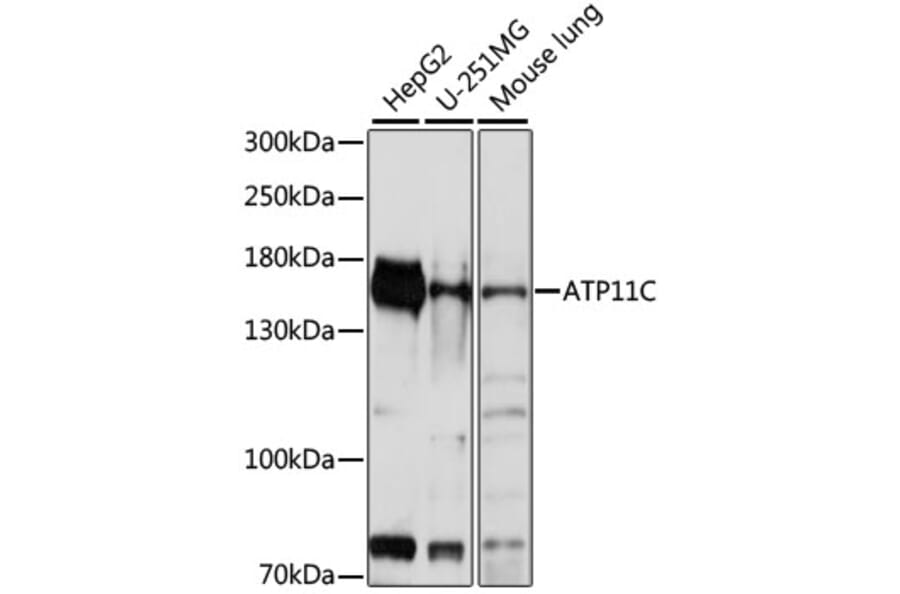 Western Blot - Anti-ATP11C Antibody (A88371) - Antibodies.com