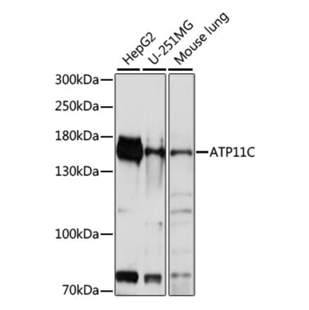 Western Blot - Anti-ATP11C Antibody (A88371) - Antibodies.com