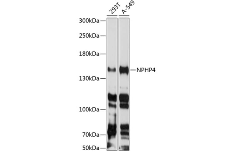 Western Blot - Anti-NPHP4 Antibody (A88372) - Antibodies.com