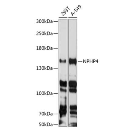 Western Blot - Anti-NPHP4 Antibody (A88372) - Antibodies.com