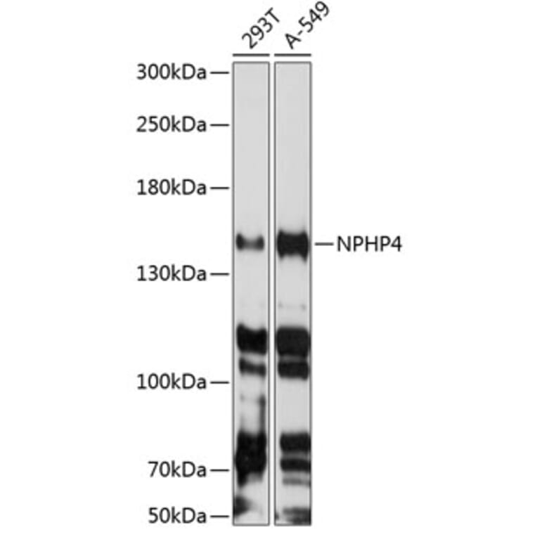 Western Blot - Anti-NPHP4 Antibody (A88372) - Antibodies.com