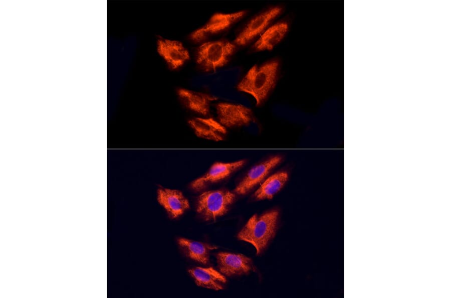 Immunofluorescence - Anti-NPHP4 Antibody (A88372) - Antibodies.com