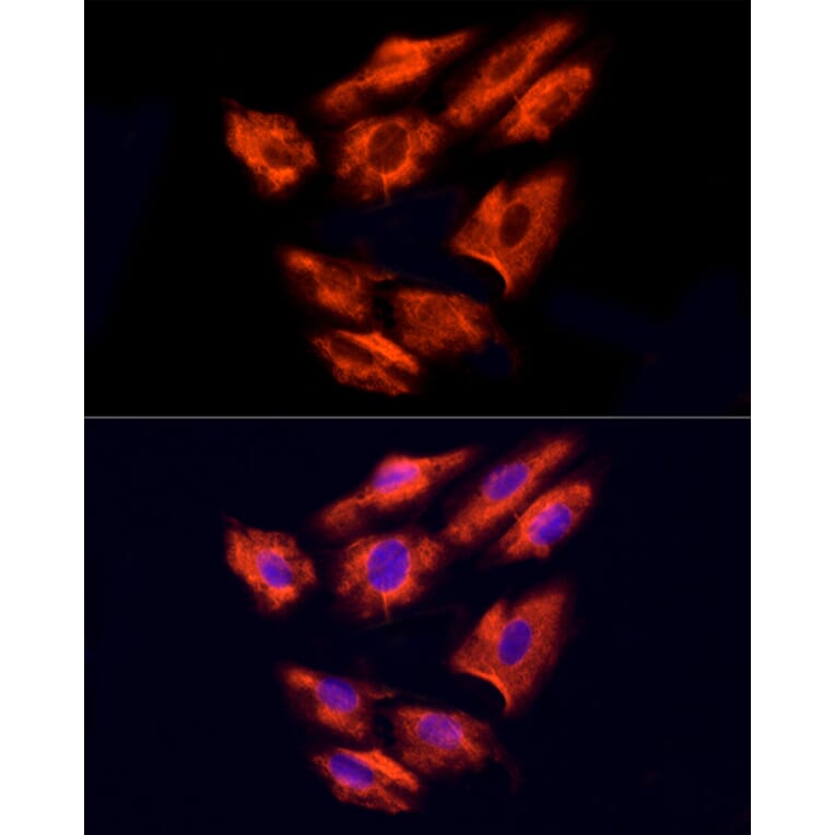 Immunofluorescence - Anti-NPHP4 Antibody (A88372) - Antibodies.com