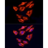 Immunofluorescence - Anti-NPHP4 Antibody (A88372) - Antibodies.com