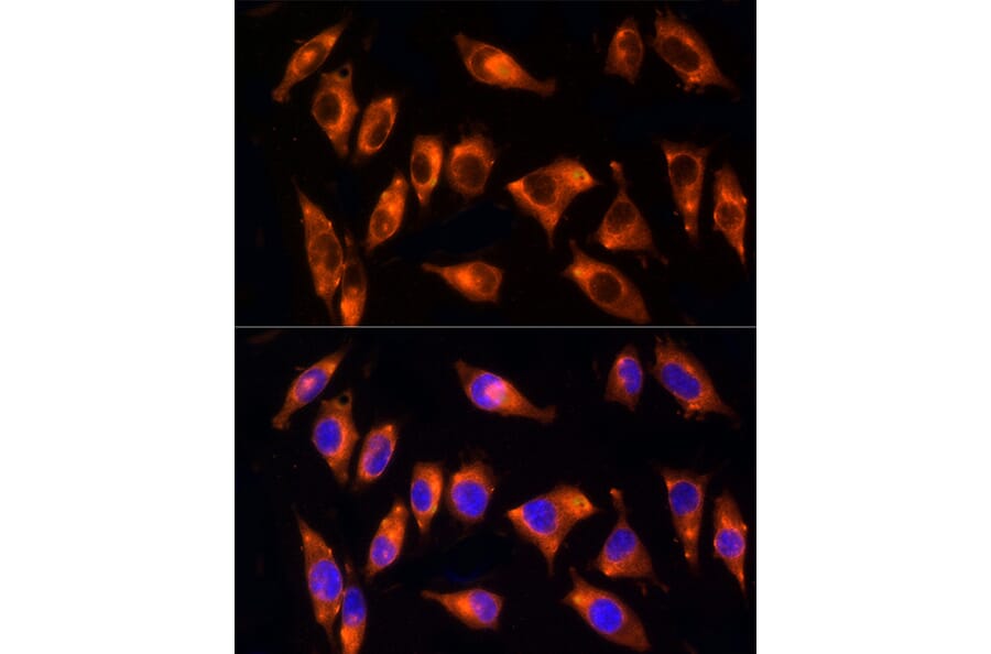 Immunofluorescence - Anti-NPHP4 Antibody (A88372) - Antibodies.com