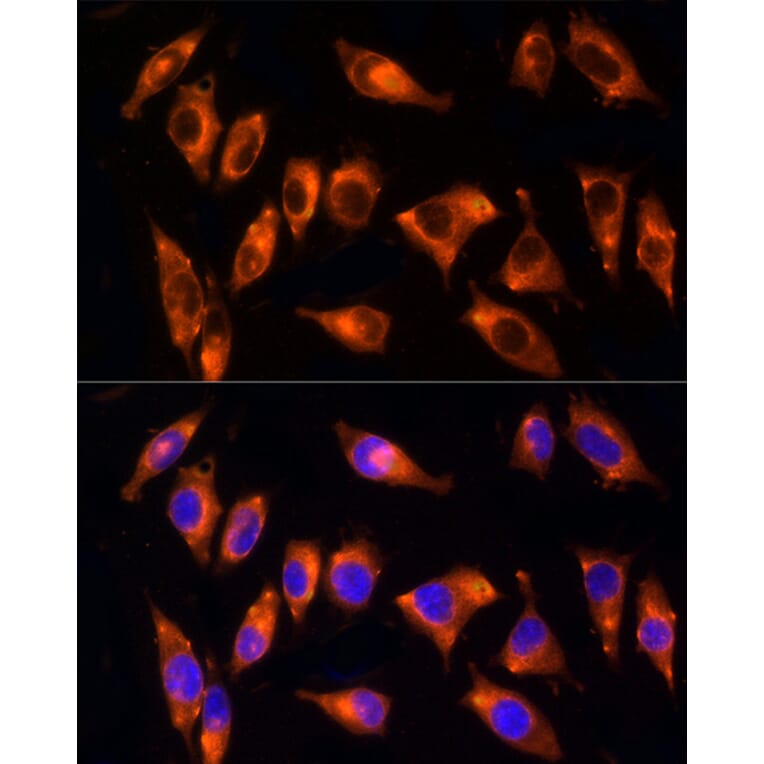 Immunofluorescence - Anti-NPHP4 Antibody (A88372) - Antibodies.com