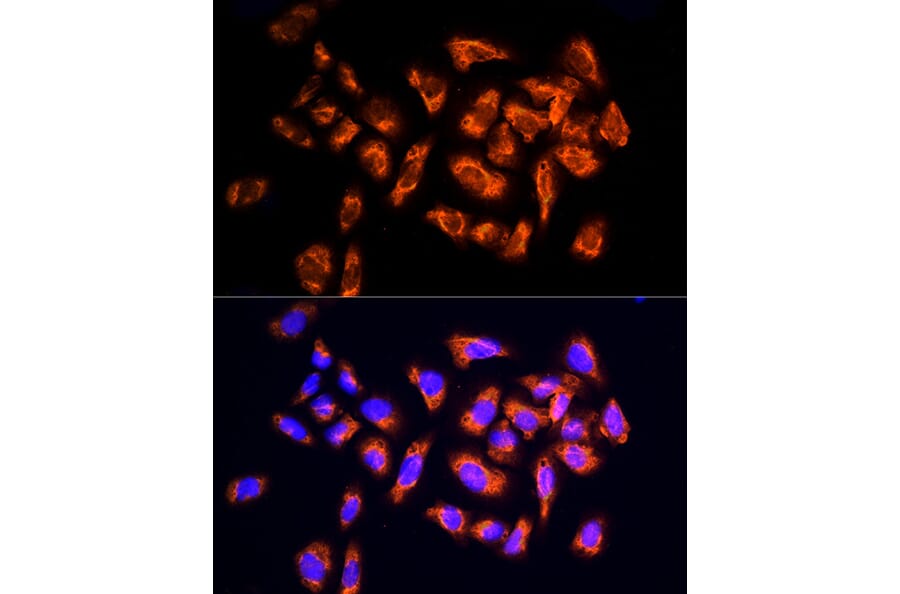 Immunofluorescence - Anti-NPHP4 Antibody (A88372) - Antibodies.com