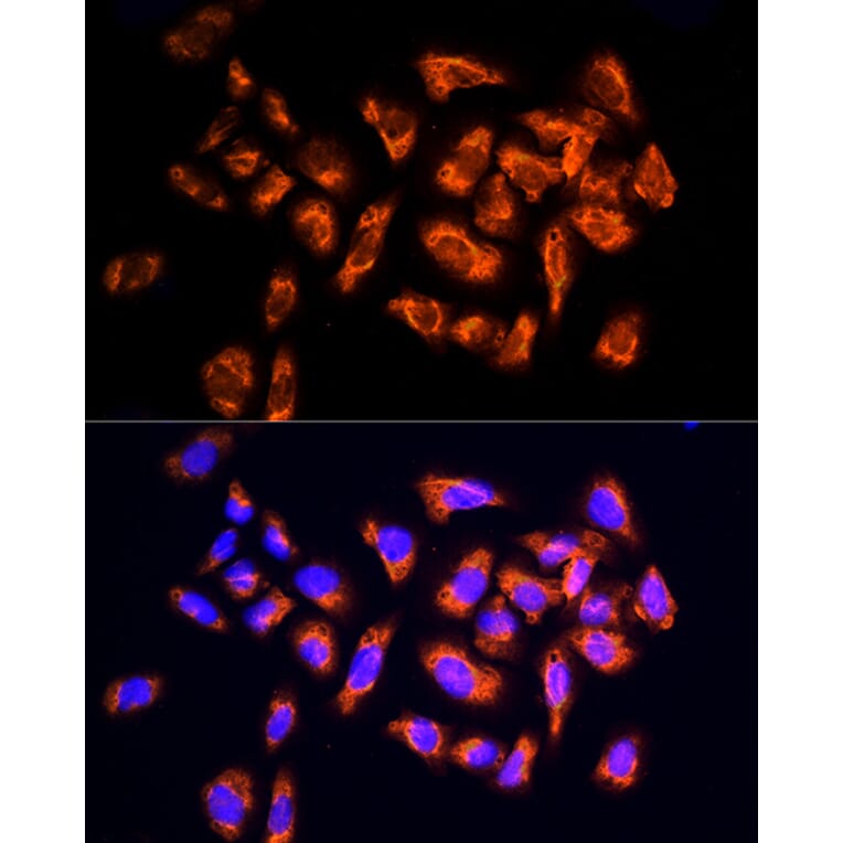 Immunofluorescence - Anti-NPHP4 Antibody (A88372) - Antibodies.com