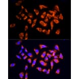 Immunofluorescence - Anti-NPHP4 Antibody (A88372) - Antibodies.com