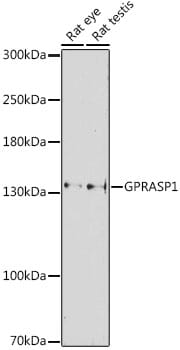 Western blot analysis of extracts of various cell lines, using Anti-GPRASP1 Antibody (A16090) at 1:1,000 dilution.
Secondary antibody: Goat Anti-Rabbit IgG (H+L) (HRP) (AS014) at 1:10,000 dilution.
Lysates / proteins: 25µg per lane.
Blocking buffer: 3% non-fat dry milk in TBST.
Detection: ECL Basic Kit (RM00020).
Exposure time: 90s.