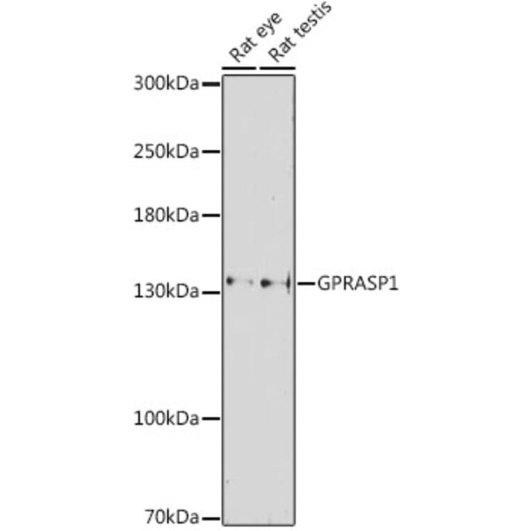 Western Blot - Anti-GASP Antibody (A88373) - Antibodies.com