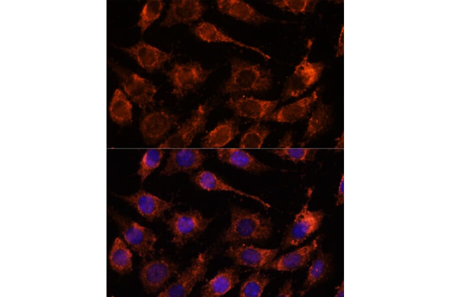 Immunofluorescence - Anti-GASP Antibody (A88373) - Antibodies.com