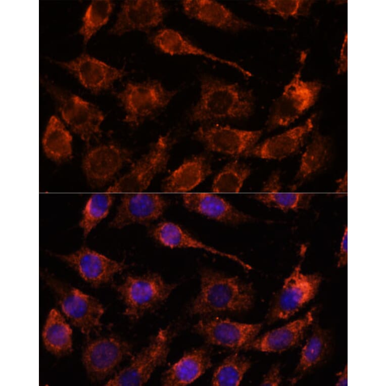 Immunofluorescence - Anti-GASP Antibody (A88373) - Antibodies.com
