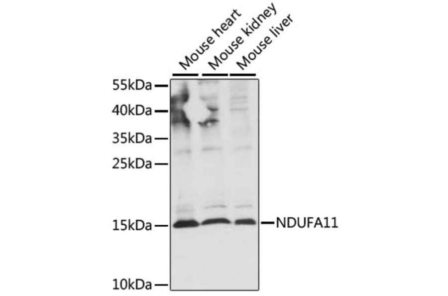 Western Blot - Anti-NDUAB Antibody (A88374) - Antibodies.com