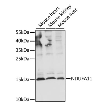 Western Blot - Anti-NDUAB Antibody (A88374) - Antibodies.com