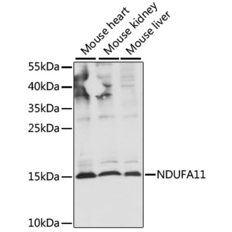 Western Blot - Anti-NDUAB Antibody (A88374) - Antibodies.com