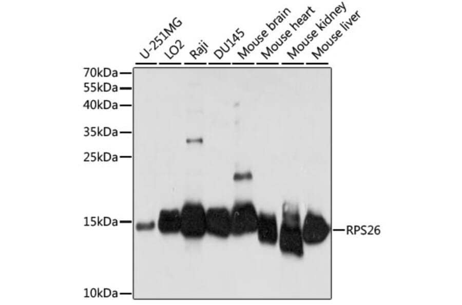 Western Blot - Anti-RPS26 Antibody (A88375) - Antibodies.com