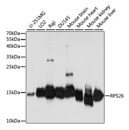 Western Blot - Anti-RPS26 Antibody (A88375) - Antibodies.com