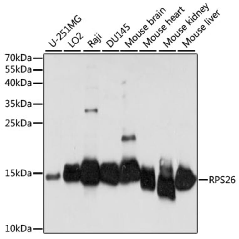 Western Blot - Anti-RPS26 Antibody (A88375) - Antibodies.com