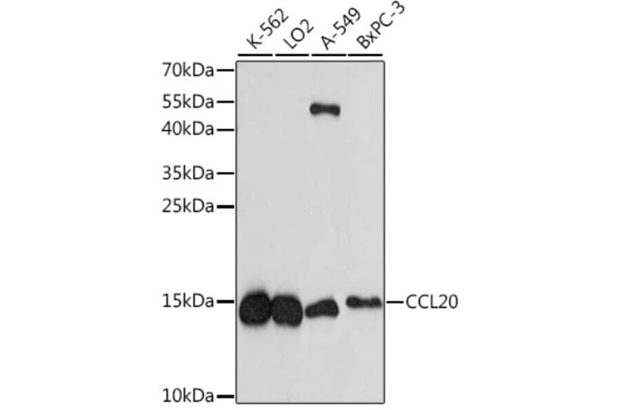Western Blot - Anti-Macrophage Inflammatory Protein 3 alpha Antibody (A88376) - Antibodies.com