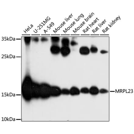 Western Blot - Anti-MRPL23 Antibody (A88377) - Antibodies.com