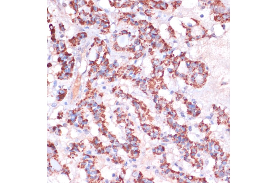 Immunohistochemistry - Anti-MRPL23 Antibody (A88377) - Antibodies.com