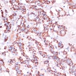 Immunohistochemistry - Anti-MRPL23 Antibody (A88377) - Antibodies.com