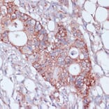 Immunohistochemistry - Anti-MRPL23 Antibody (A88377) - Antibodies.com