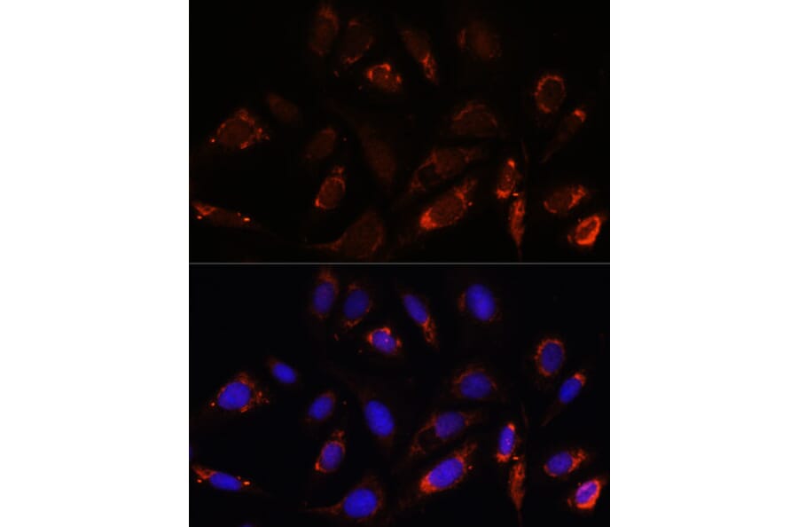 Immunofluorescence - Anti-MRPL23 Antibody (A88377) - Antibodies.com