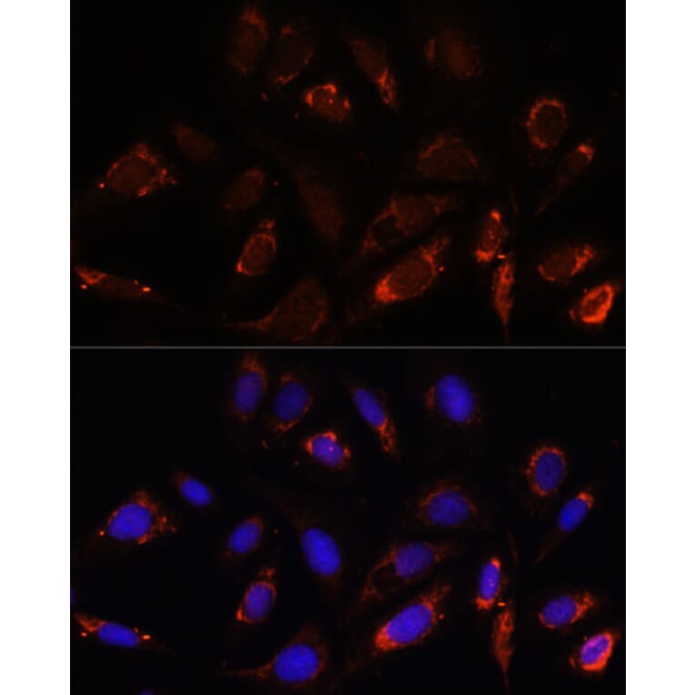 Immunofluorescence - Anti-MRPL23 Antibody (A88377) - Antibodies.com