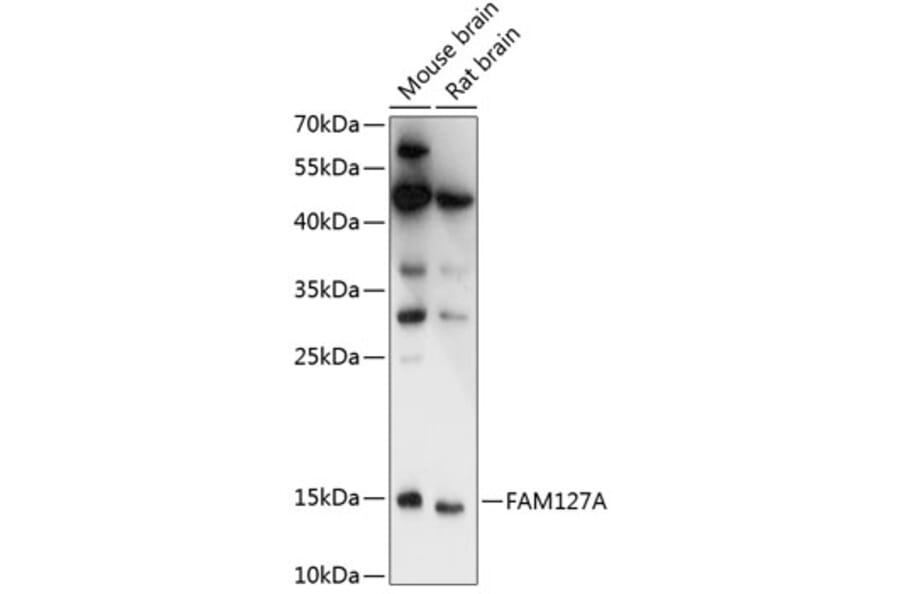 Western Blot - Anti-CXX1 Antibody (A88378) - Antibodies.com