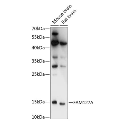 Western Blot - Anti-CXX1 Antibody (A88378) - Antibodies.com