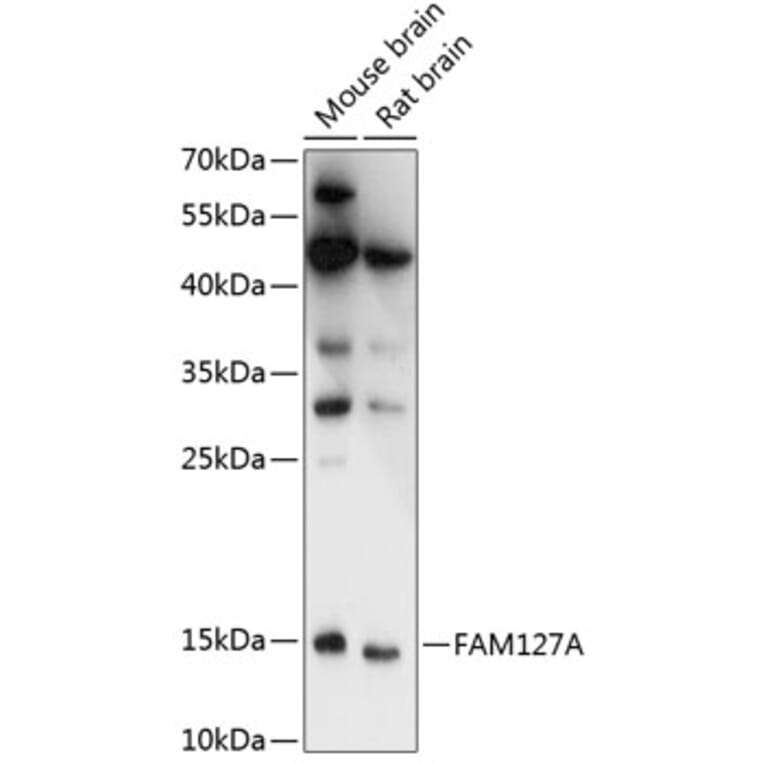 Western Blot - Anti-CXX1 Antibody (A88378) - Antibodies.com