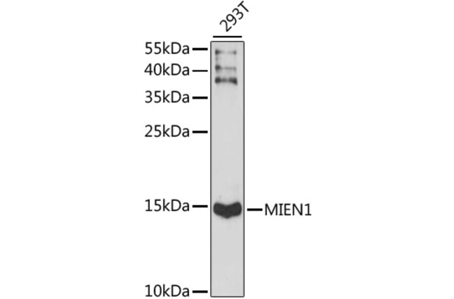 Western Blot - Anti-XTP4 Antibody (A88379) - Antibodies.com